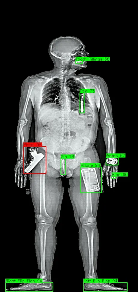 JUKA™ scan with DISCERN™ classification showing detected objects mapped on the body