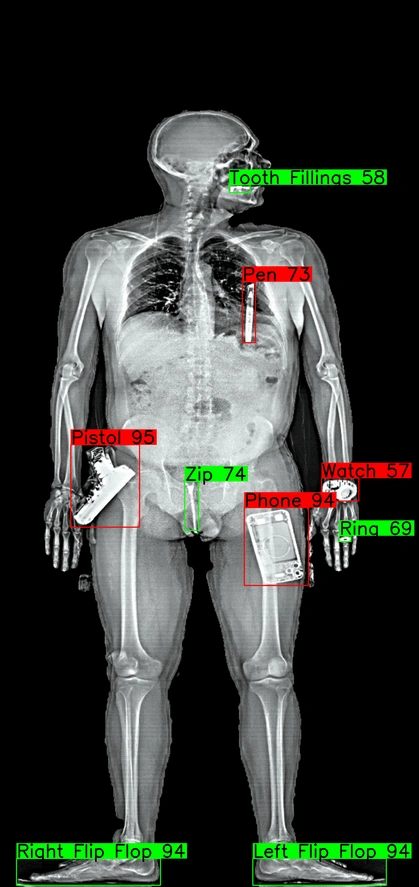 JUKA™ scan with DISCERN™ classification showing detected objects mapped on the body