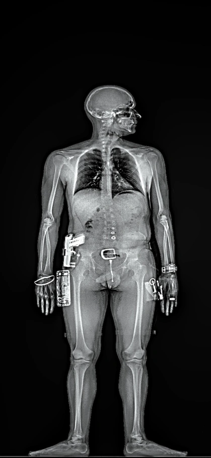 Before JUKA™ scan showing limited detection with traditional X-ray technology